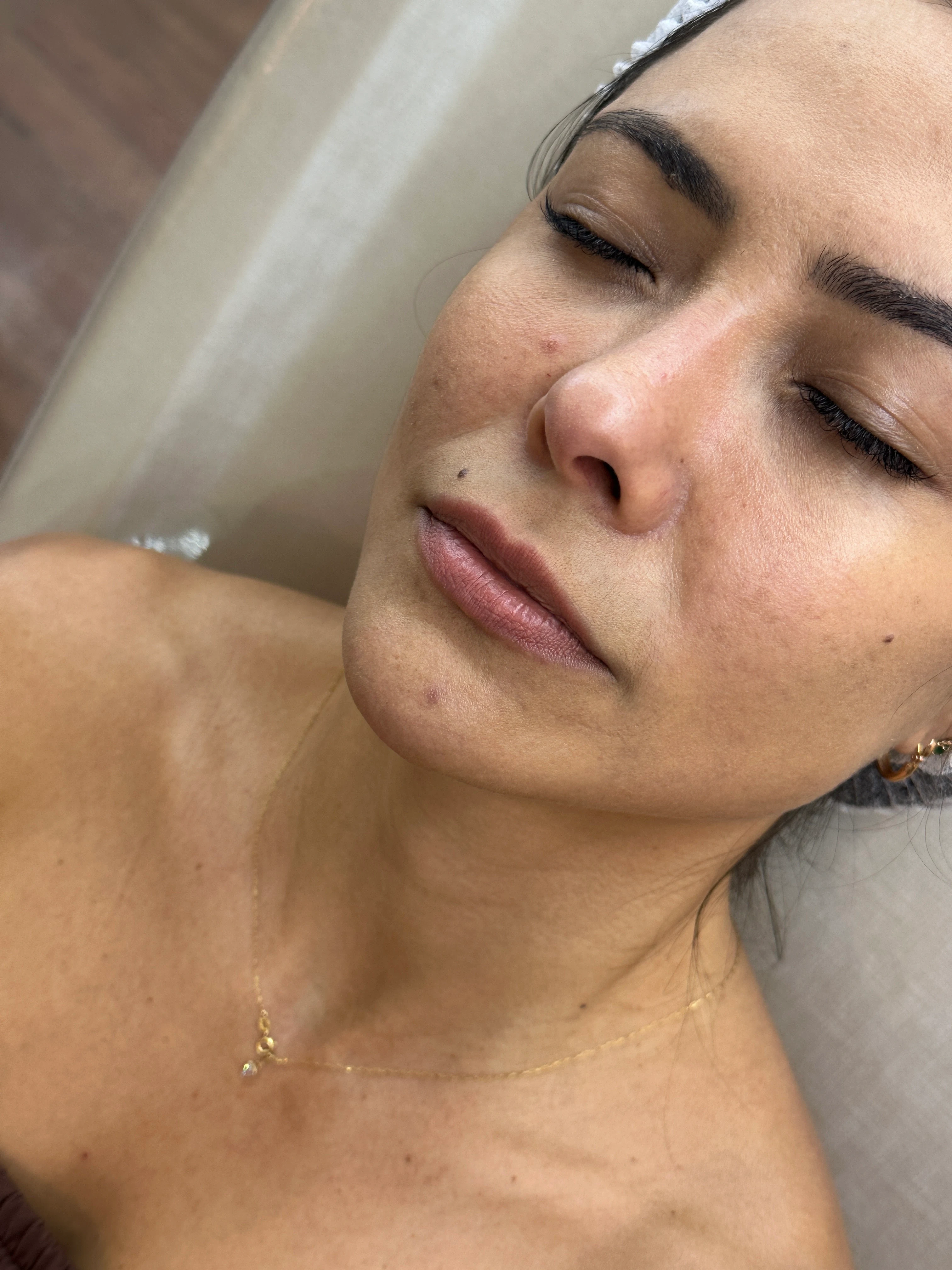 Paciente antes do procedimento