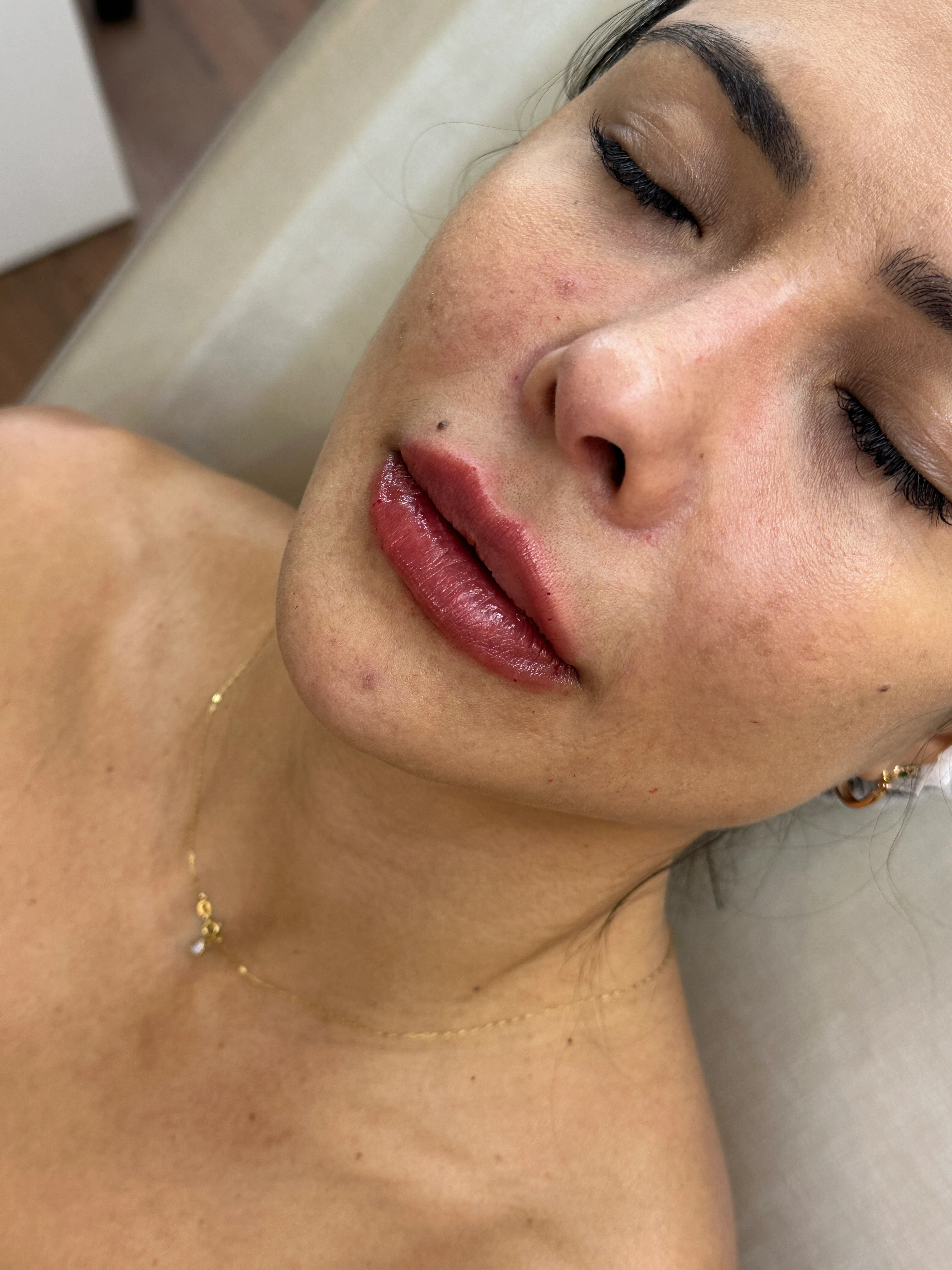 Paciente depois do procedimento