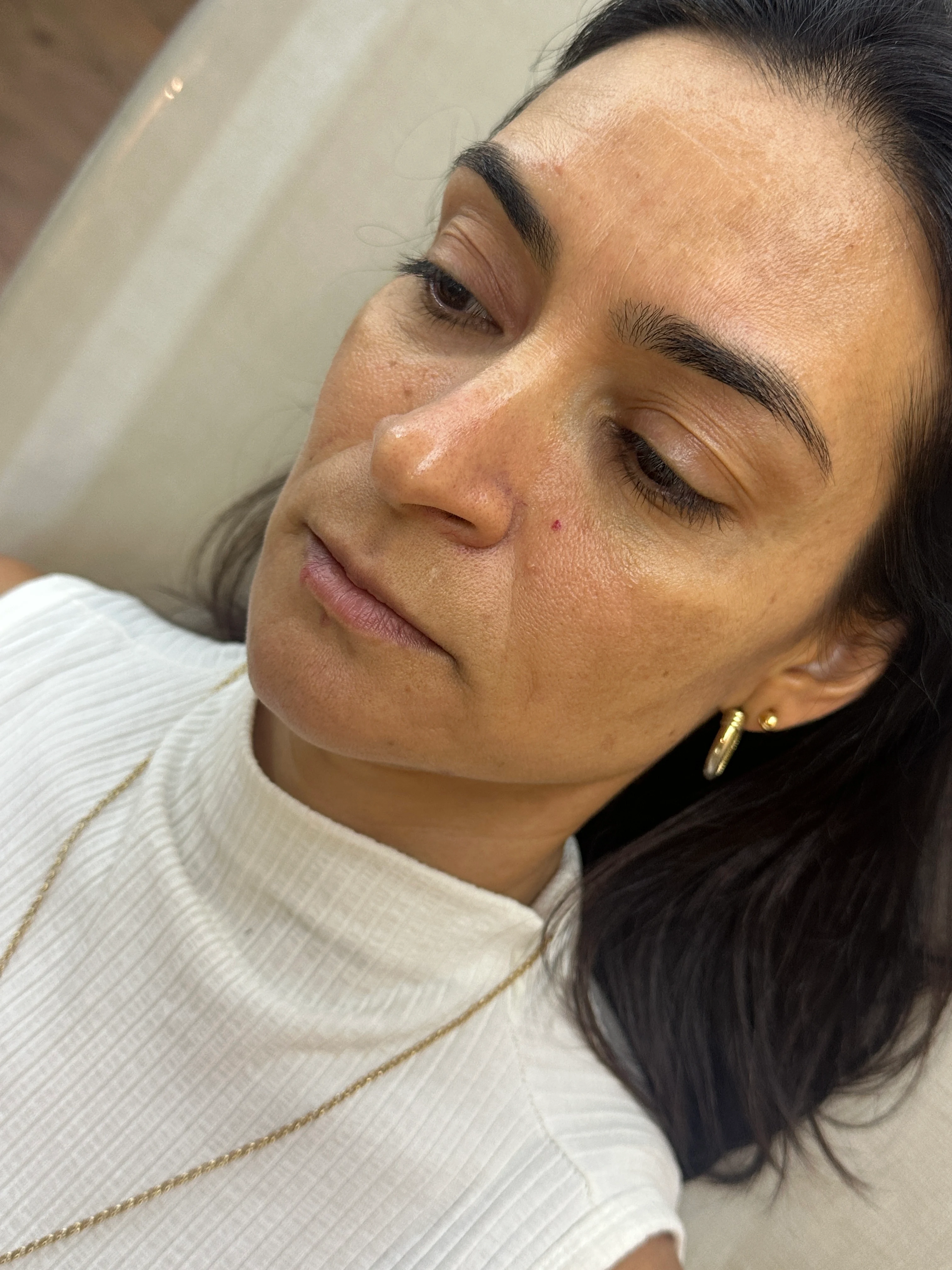 Paciente antes do procedimento