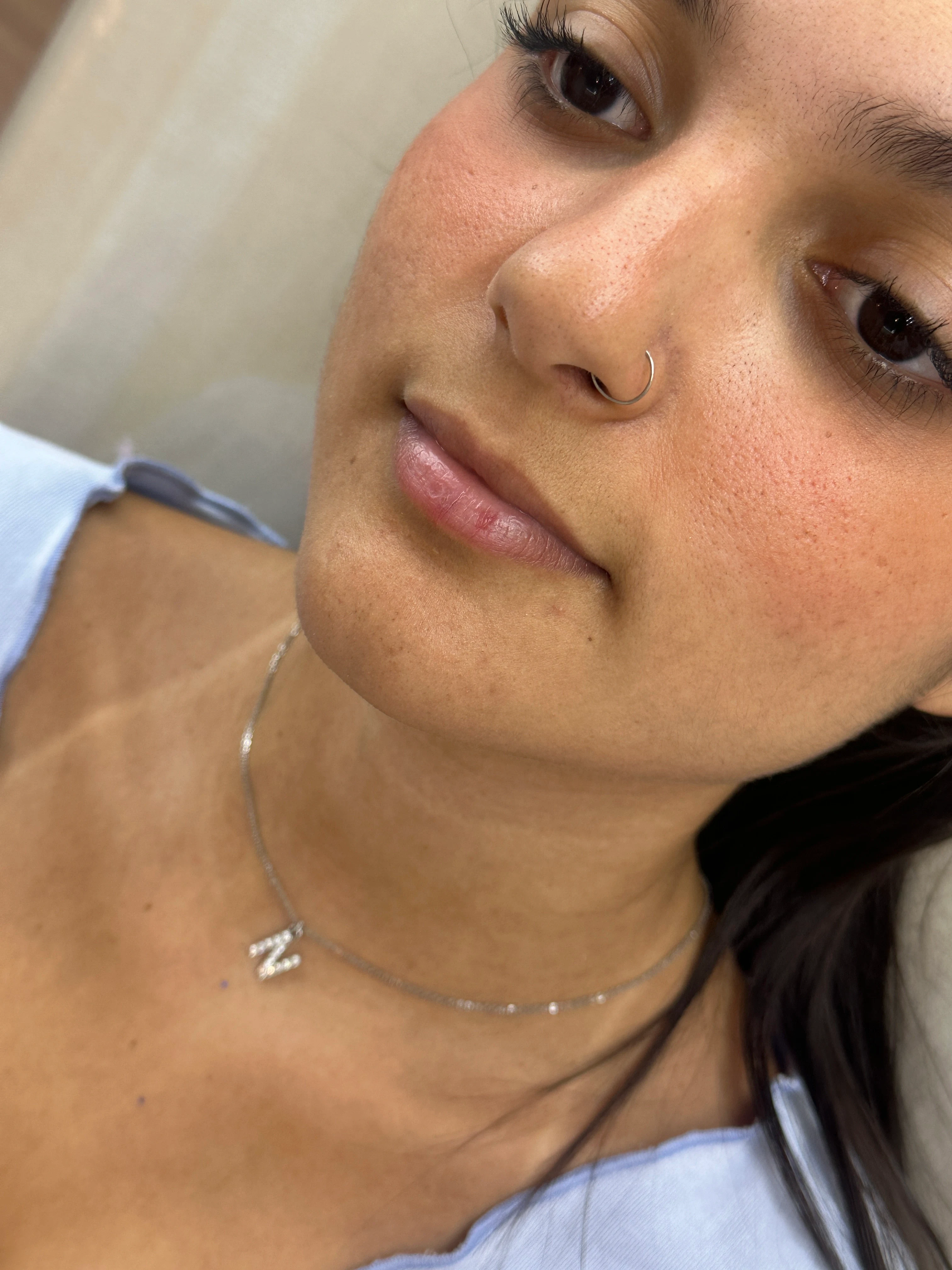 Paciente antes do procedimento